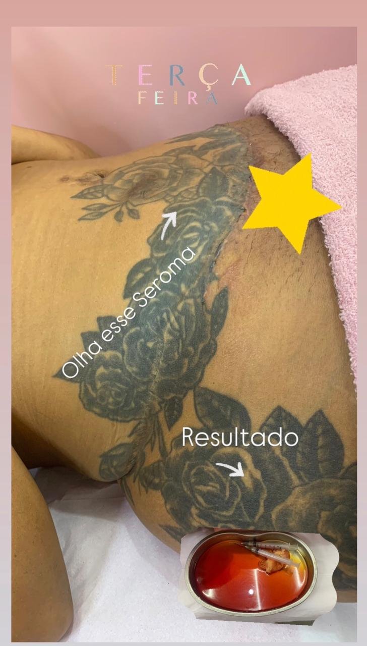 Imagem relacionada ao atendimento pós-operatório